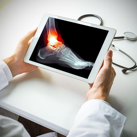 foot-ankle-doctor-phoenix Foot and Ankle Doctor in Phoenix
